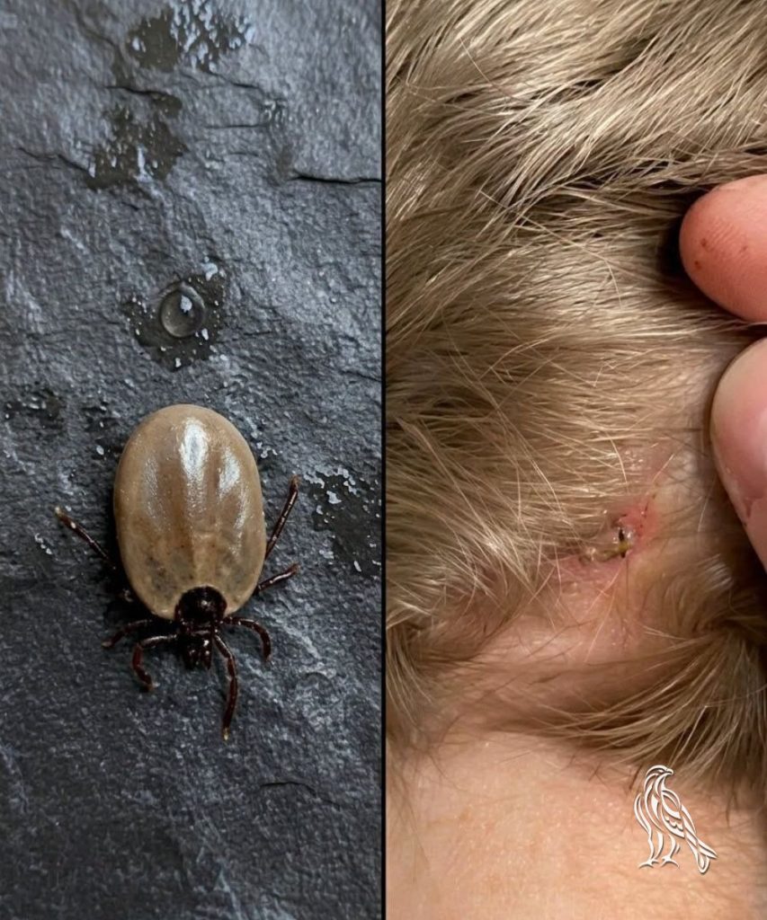 How to stay calm when you find unwanted “guests” in your child’s hair.How to stay calm when you find unwanted “guests” in your child’s hair.