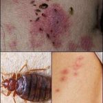 ⚠️ BE CAREFUL, If you spot these dots on your skin, it means you have Ca…