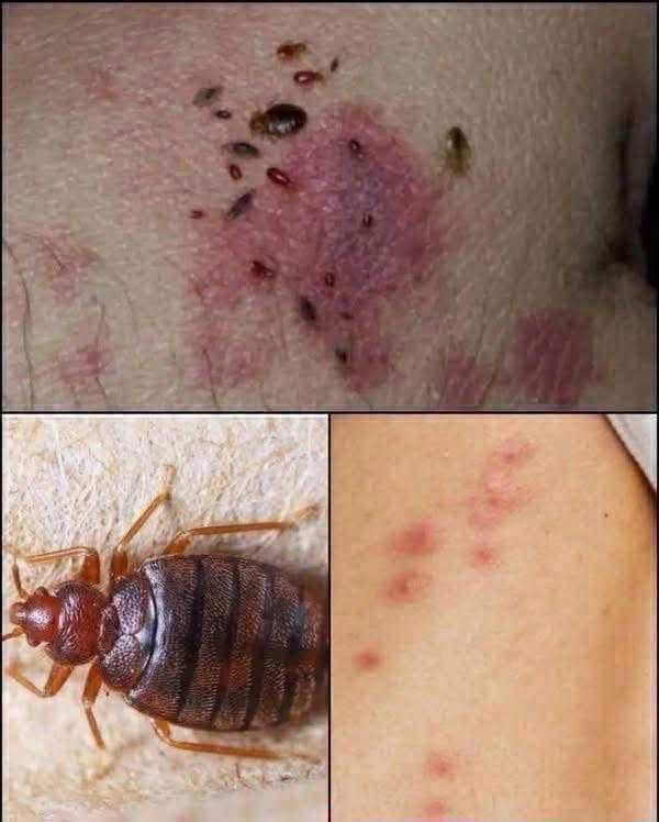 ⚠️ BE CAREFUL, If you spot these dots on your skin, it means you have Ca…