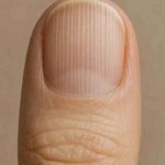 Your Fingernails Are Trying to Warn You of a Hidden Danger, But You’re Ignoring the Most Critical Clues