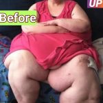 She once weighed 350kg — but after losing 200kg, her life and body changed completely