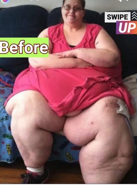She once weighed 350kg — but after losing 200kg, her life and body changed completely